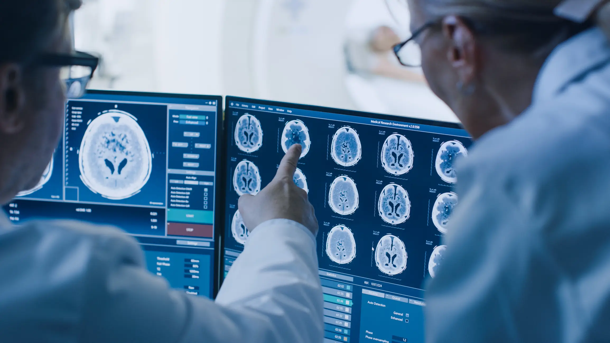 Medical professionals reviewing brain MRI scans on computer monitors.